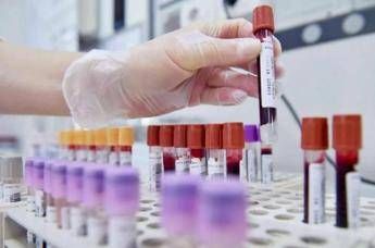Sclerosi multipla recidivante, Ema raccomanda approvazione ocrelizumab dai 10 anni
