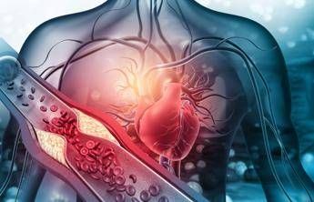 Arterosclerosi, studio: “Nuova molecola riduce di più il colesterolo cattivo”
